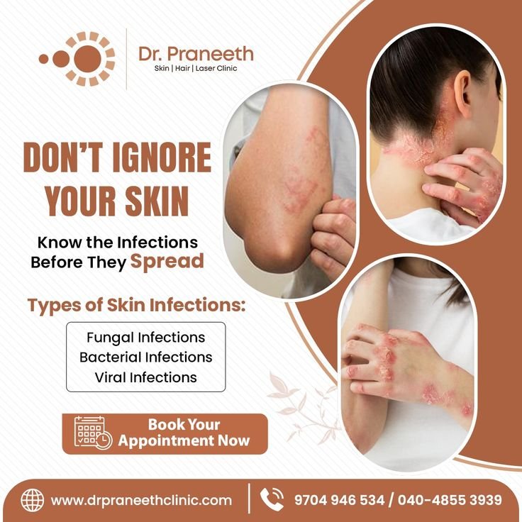 derma